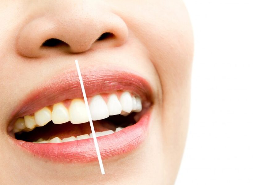 woman-whitening-treatment_1232-185